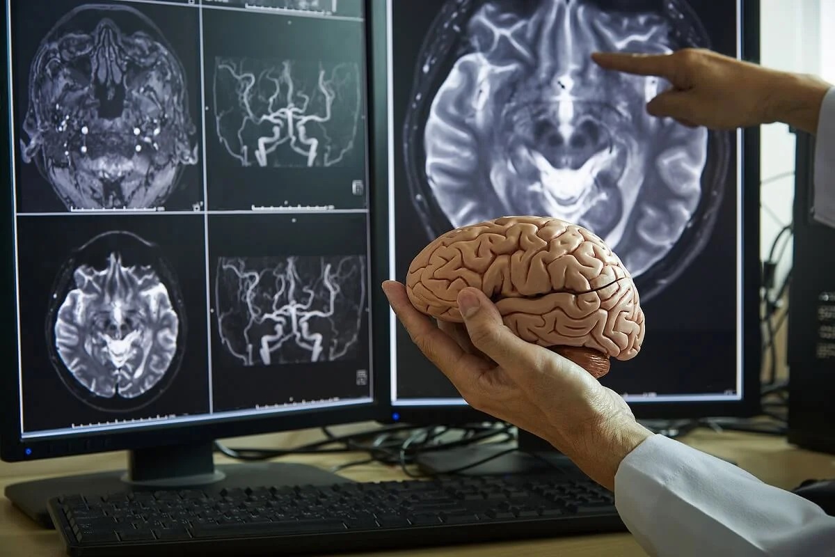 realizan estudios del cerebro humano