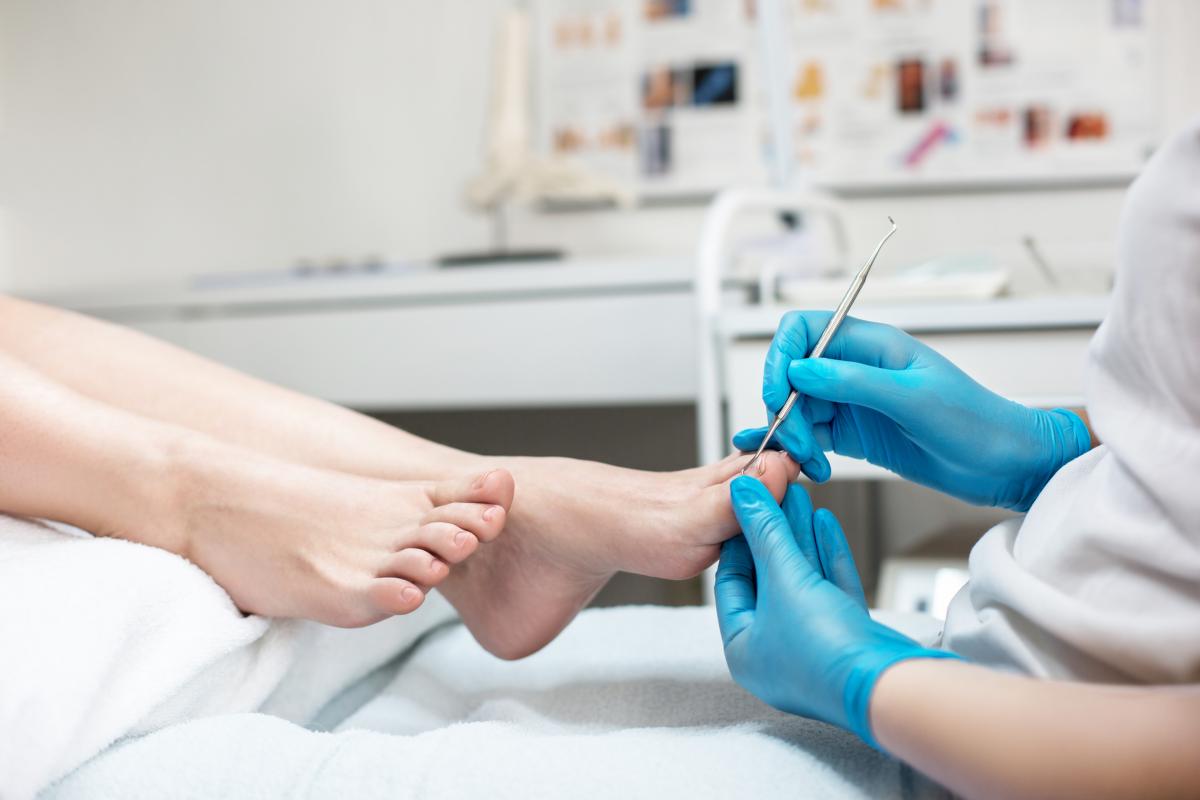 diagnóstico de las uñas amarillentas